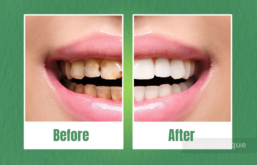 ProDentim Support The Health Of Your Gums